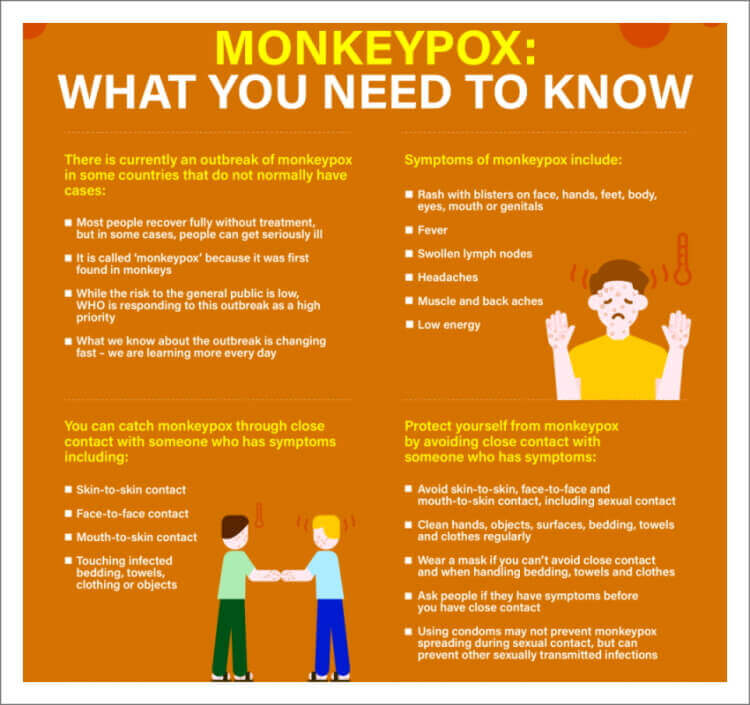 원숭이두창 증상